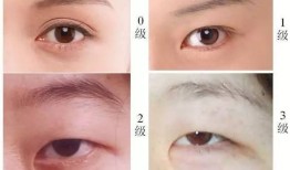 双眼皮术后后遗症，了解可能的风险与预防措施