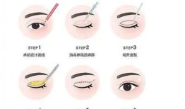 双眼皮手术对身体的影响及其注意事项