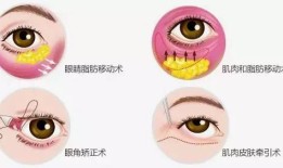 双眼皮手术对身体的影响及其注意事项