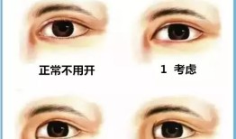 双眼皮术后后遗症，了解可能的风险与预防措施