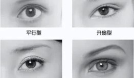 双眼皮术后后遗症，了解可能的风险与预防措施