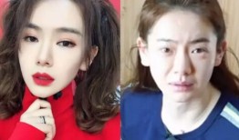 双眼皮手术，后遗症与风险全解析