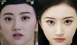 双眼皮手术后的常见后遗症及其预防措施